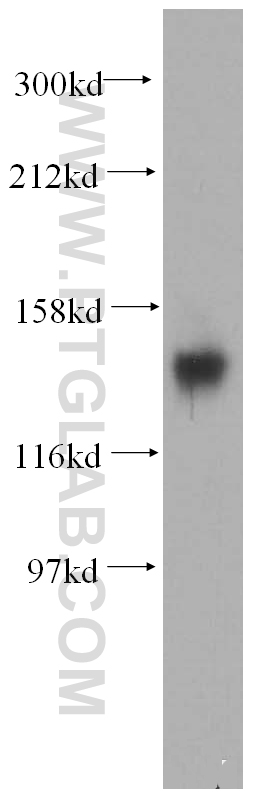 WB analysis of mouse brain using 13873-1-AP