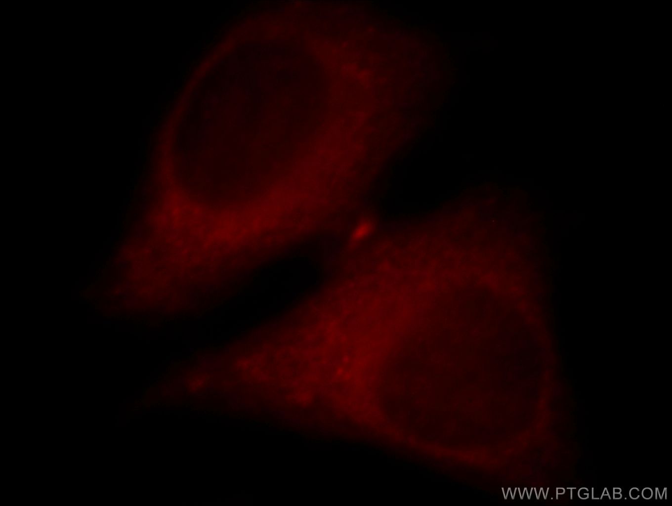 IF Staining of HepG2 using 20090-1-AP