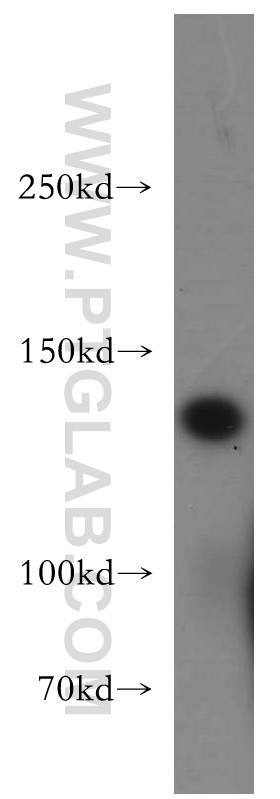 WB analysis of human testis using 20090-1-AP