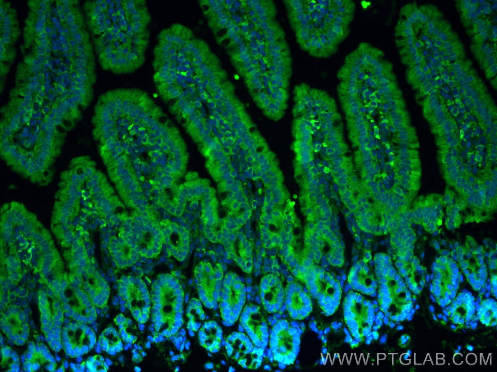 IF Staining of mouse small intestine using 17885-1-AP
