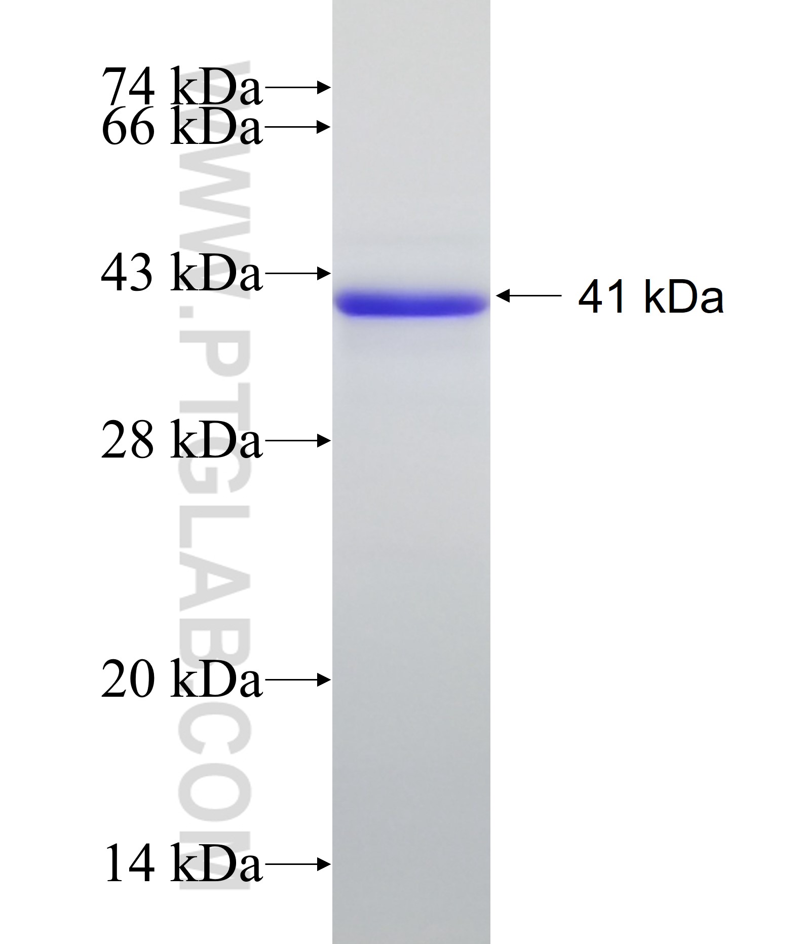 DGKQ fusion protein Ag11938 SDS-PAGE