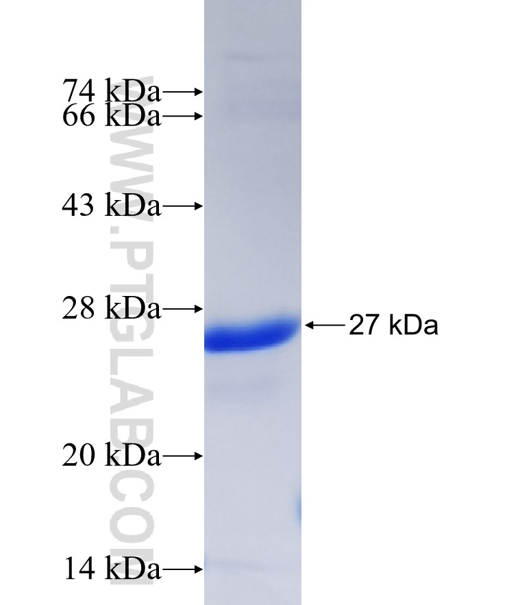 DGKZ fusion protein Ag37327 SDS-PAGE DGKZ fusion protein Ag37327 SDS-PAGE