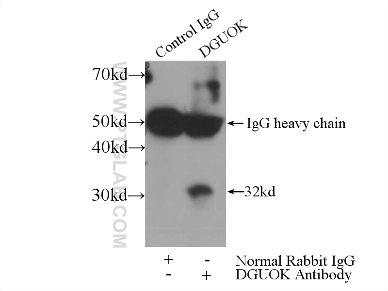 IP experiment of mouse kidney using 16459-1-AP