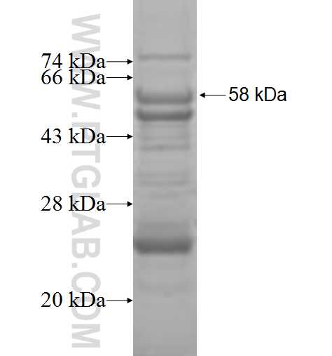 DGUOK fusion protein Ag9361 SDS-PAGE