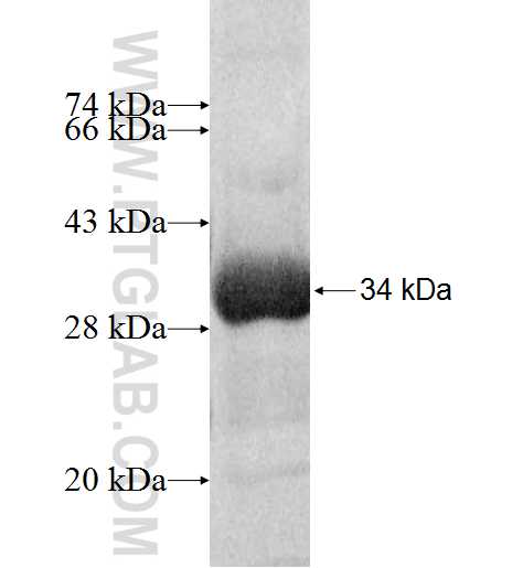 DGUOK fusion protein Ag9501 SDS-PAGE