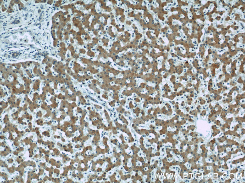 IHC staining of human liver using 10471-1-AP