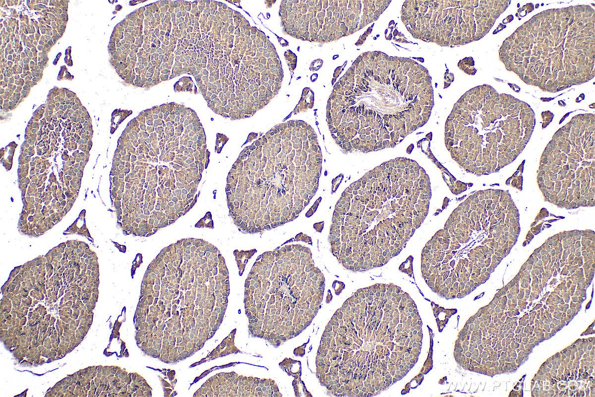 Immunohistochemical analysis of paraffin-embedded mouse testis tissue slide using 15099-1-AP (DHDDS antibody) at dilution of 1:100 (under 10x lens). Heat mediated antigen retrieval with Tris-EDTA buffer (pH 9.0). IHC staining of mouse testis using 15099-1-AP