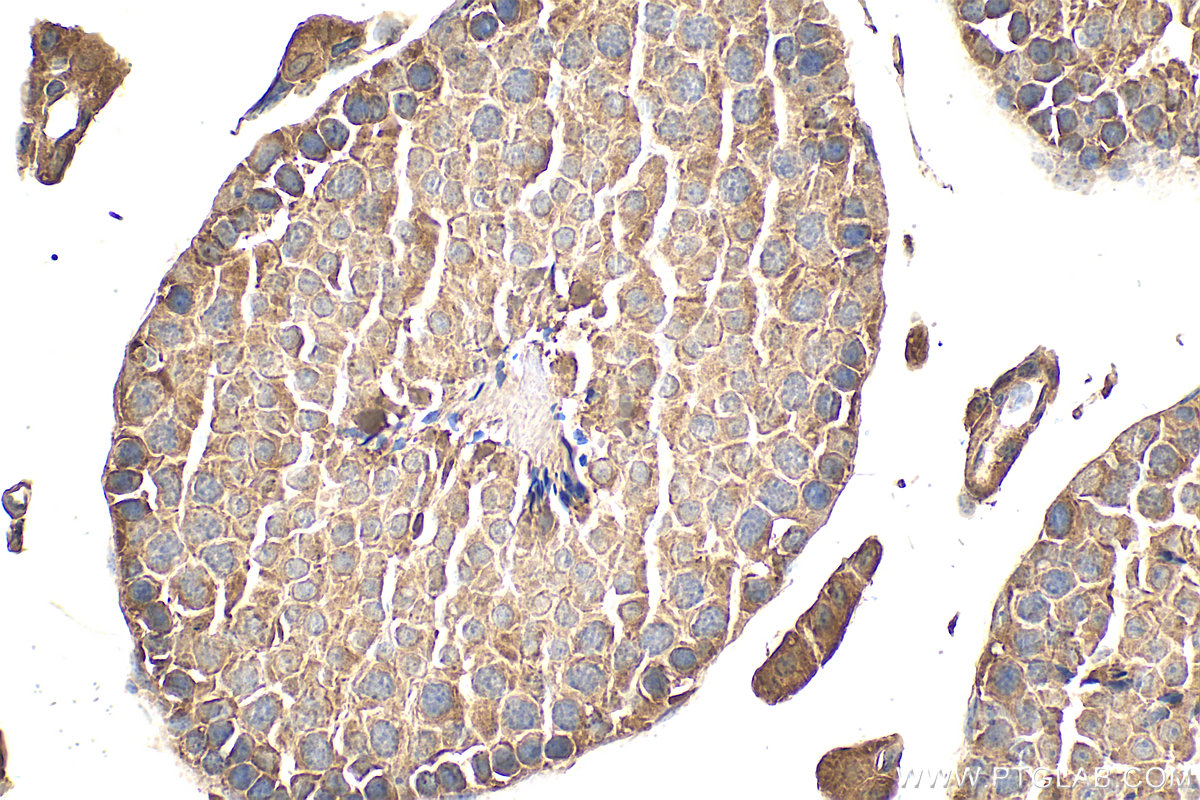 Immunohistochemical analysis of paraffin-embedded mouse testis tissue slide using 15099-1-AP (DHDDS antibody) at dilution of 1:100 (under 40x lens). Heat mediated antigen retrieval with Tris-EDTA buffer (pH 9.0). IHC staining of mouse testis using 15099-1-AP