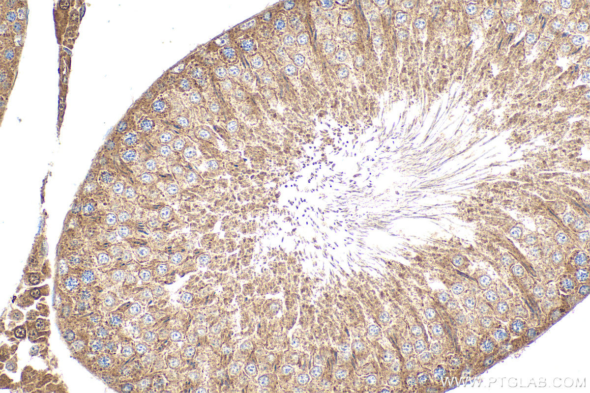 Immunohistochemical analysis of paraffin-embedded rat testis tissue slide using 15099-1-AP (DHDDS antibody) at dilution of 1:100 (under 40x lens). Heat mediated antigen retrieval with Tris-EDTA buffer (pH 9.0). IHC staining of rat testis using 15099-1-AP