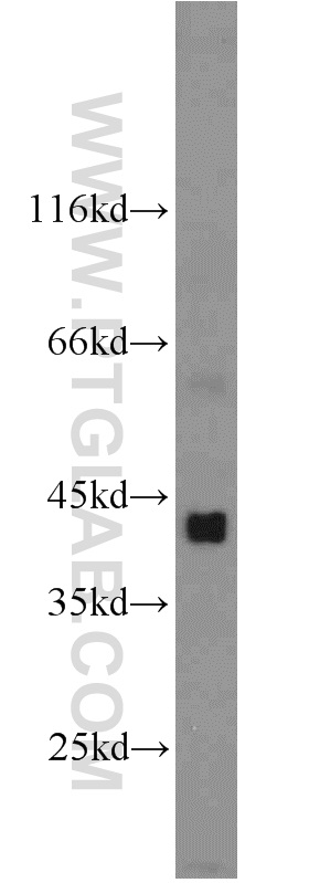 DHH Polyclonal antibody