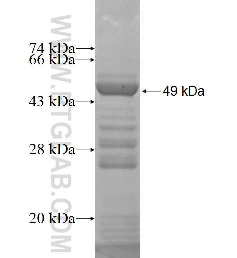 DHODH fusion protein Ag6810 SDS-PAGE DHODH fusion protein Ag6810 SDS-PAGE