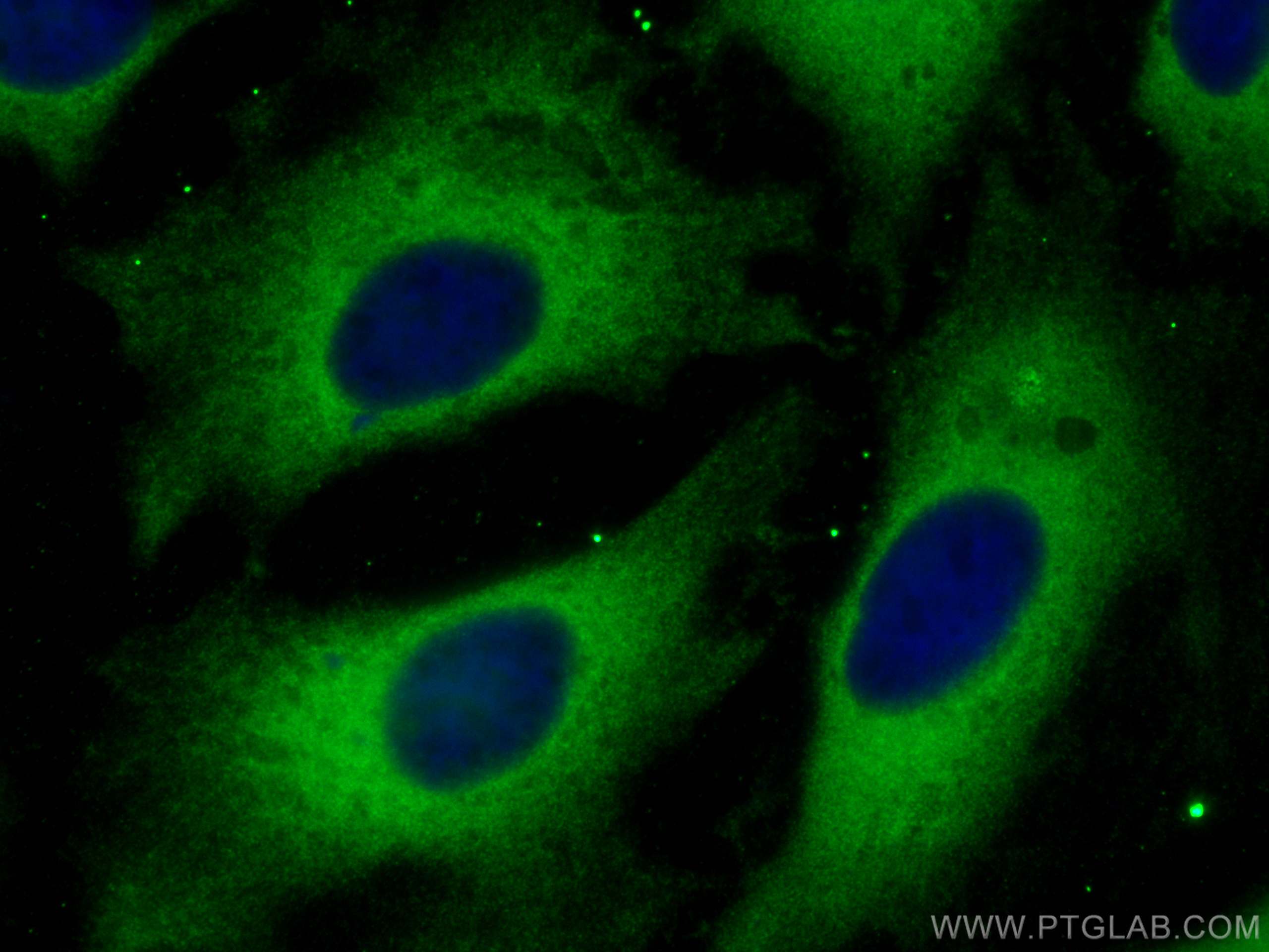 IF Staining of HeLa using 11184-1-AP