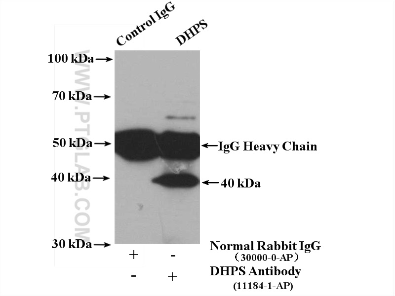 IP experiment of NIH/3T3 using 11184-1-AP