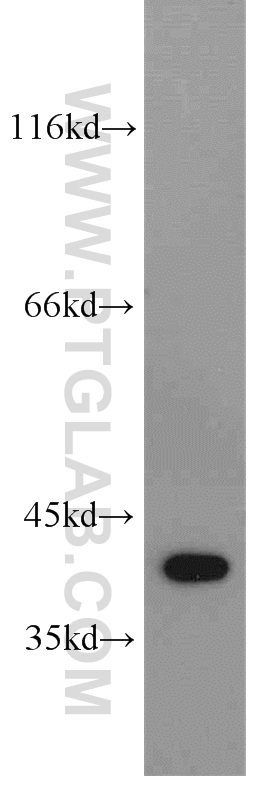 WB analysis of HeLa using 11184-1-AP