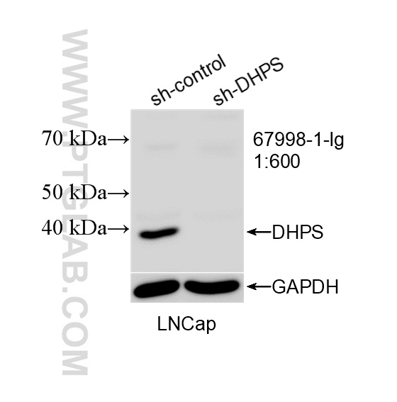 WB analysis of LNCaP using 67998-1-Ig
