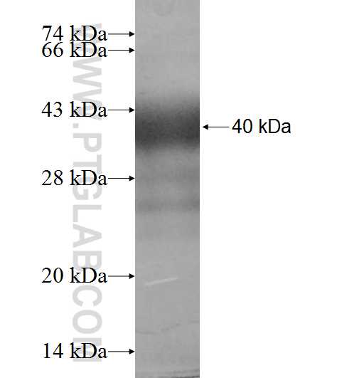 DHRS1 fusion protein Ag9628 SDS-PAGE DHRS1 fusion protein Ag9628 SDS-PAGE