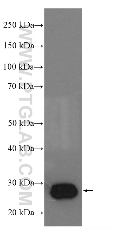 WB analysis of SKOV-3 using 15735-1-AP