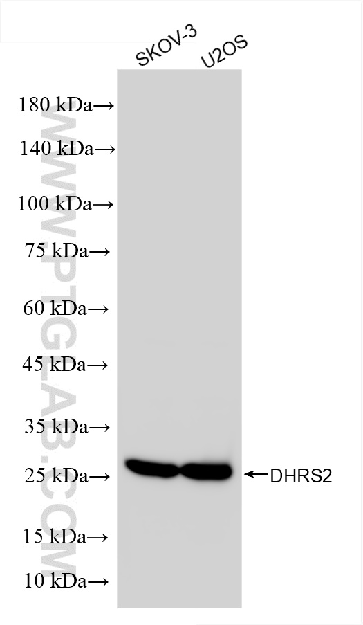 WB analysis using 86309-2-RR