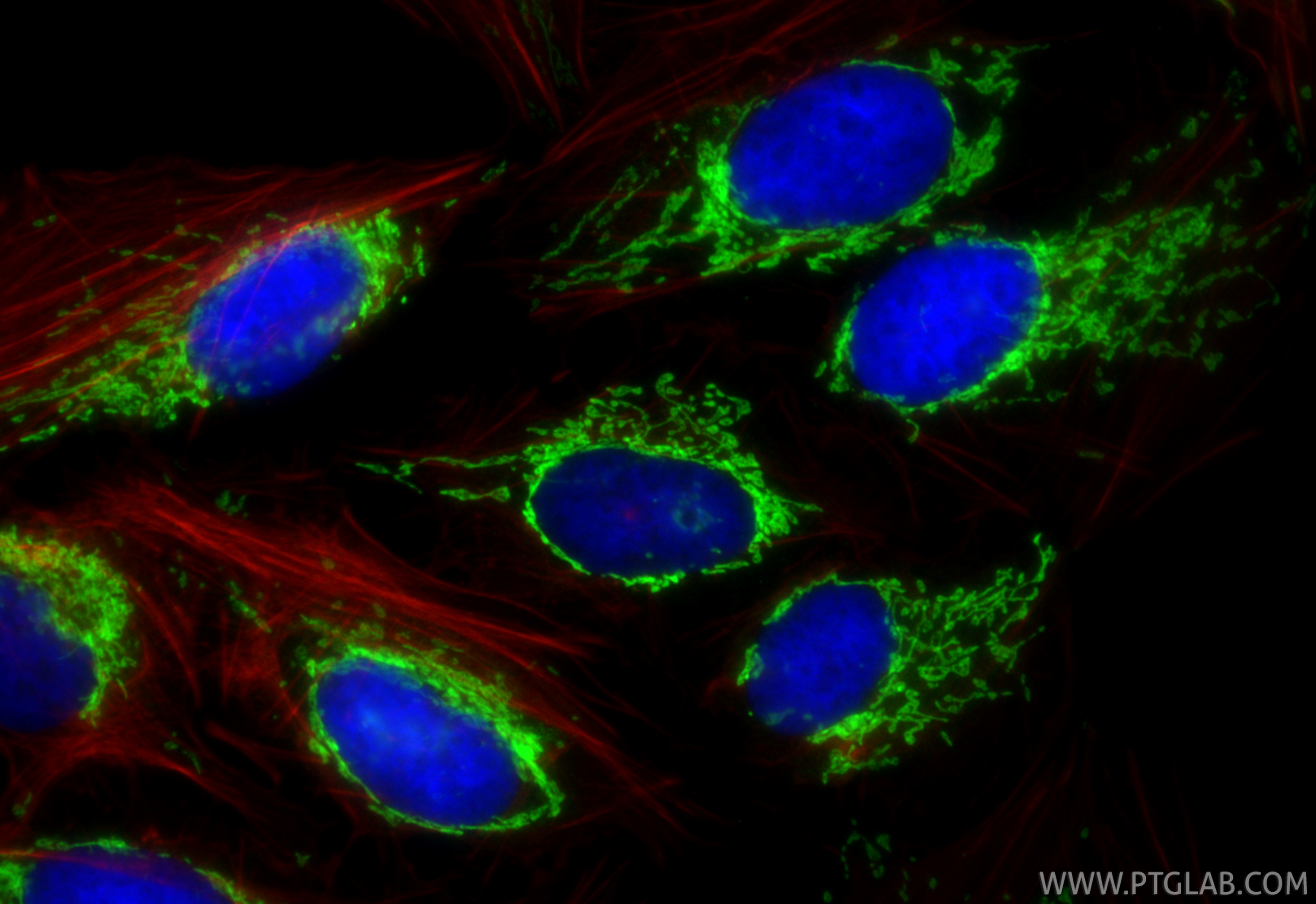 IF Staining of U2OS using RMX00088
