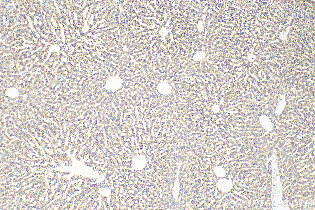 IHC staining of mouse liver using 15393-1-AP