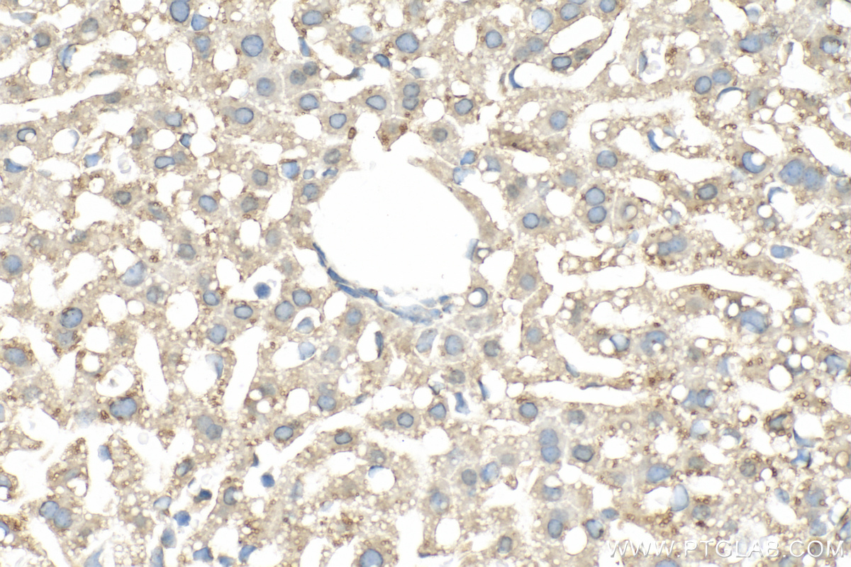 IHC staining of mouse liver using 15393-1-AP