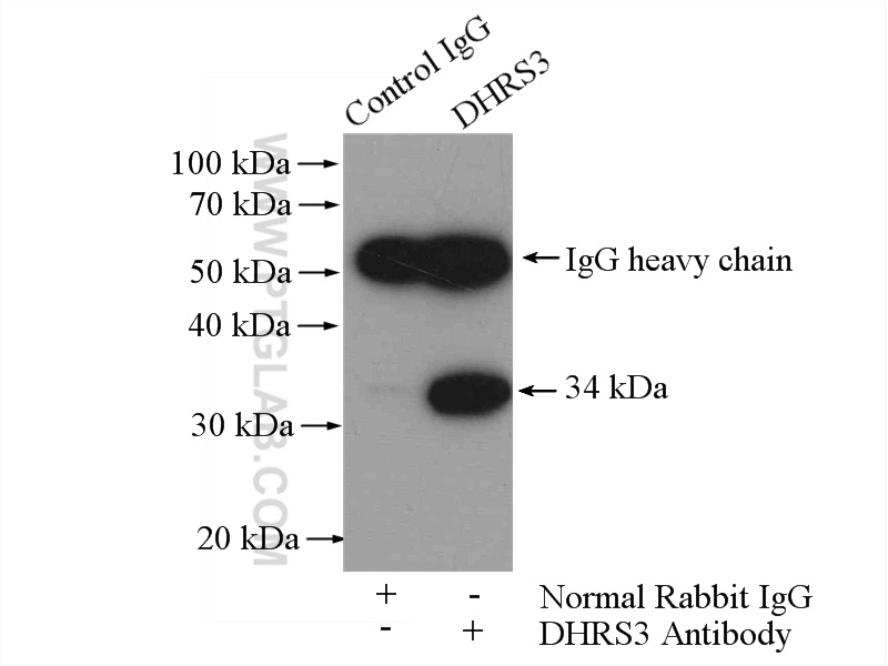 IP experiment of A375 using 15393-1-AP