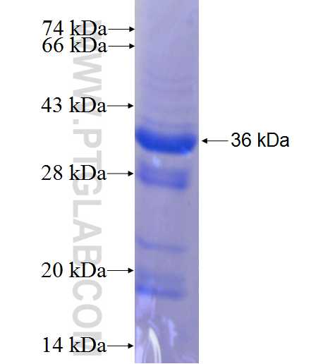 DHRS3 fusion protein Ag7961 SDS-PAGE DHRS3 fusion protein Ag7961 SDS-PAGE