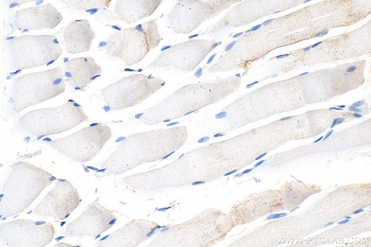 IHC staining of rat skeletal muscle using 15061-1-AP
