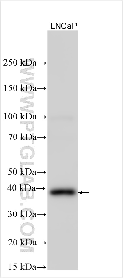 WB analysis using 15061-1-AP