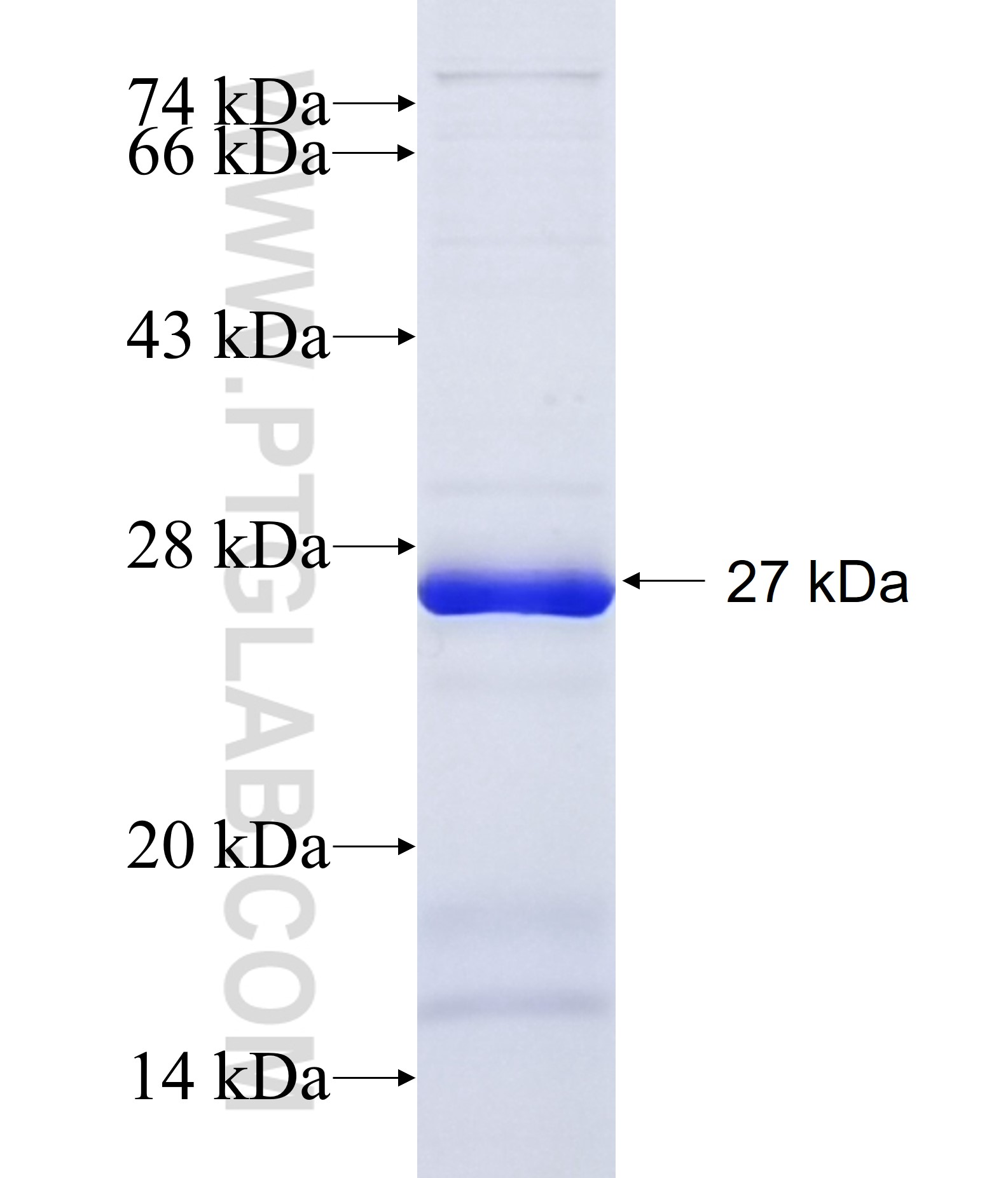 DHRS7 fusion protein Ag7046 SDS-PAGE DHRS7 fusion protein Ag7046 SDS-PAGE