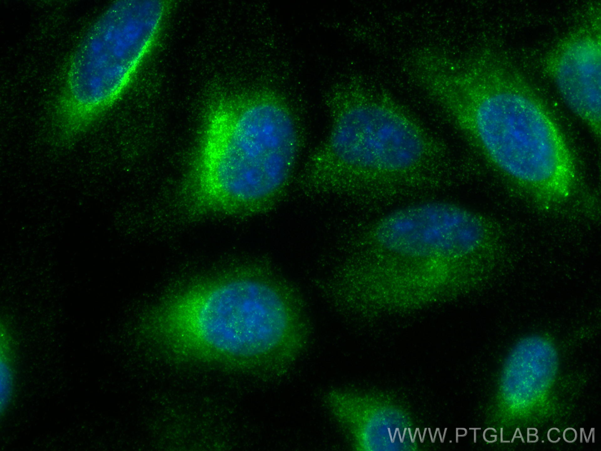 IF Staining of U2OS using 15530-1-AP