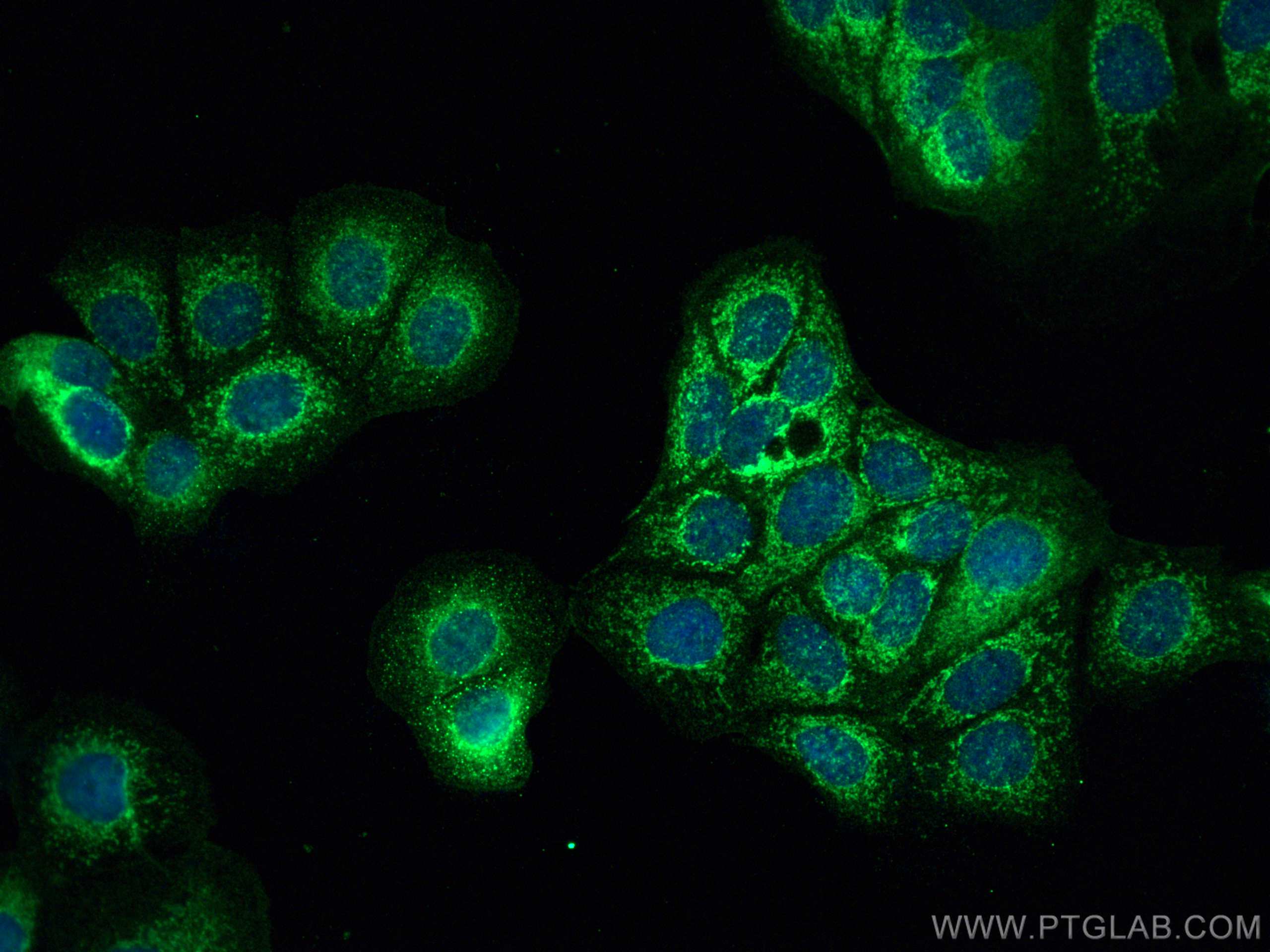 IF Staining of MCF-7 using 27493-1-AP