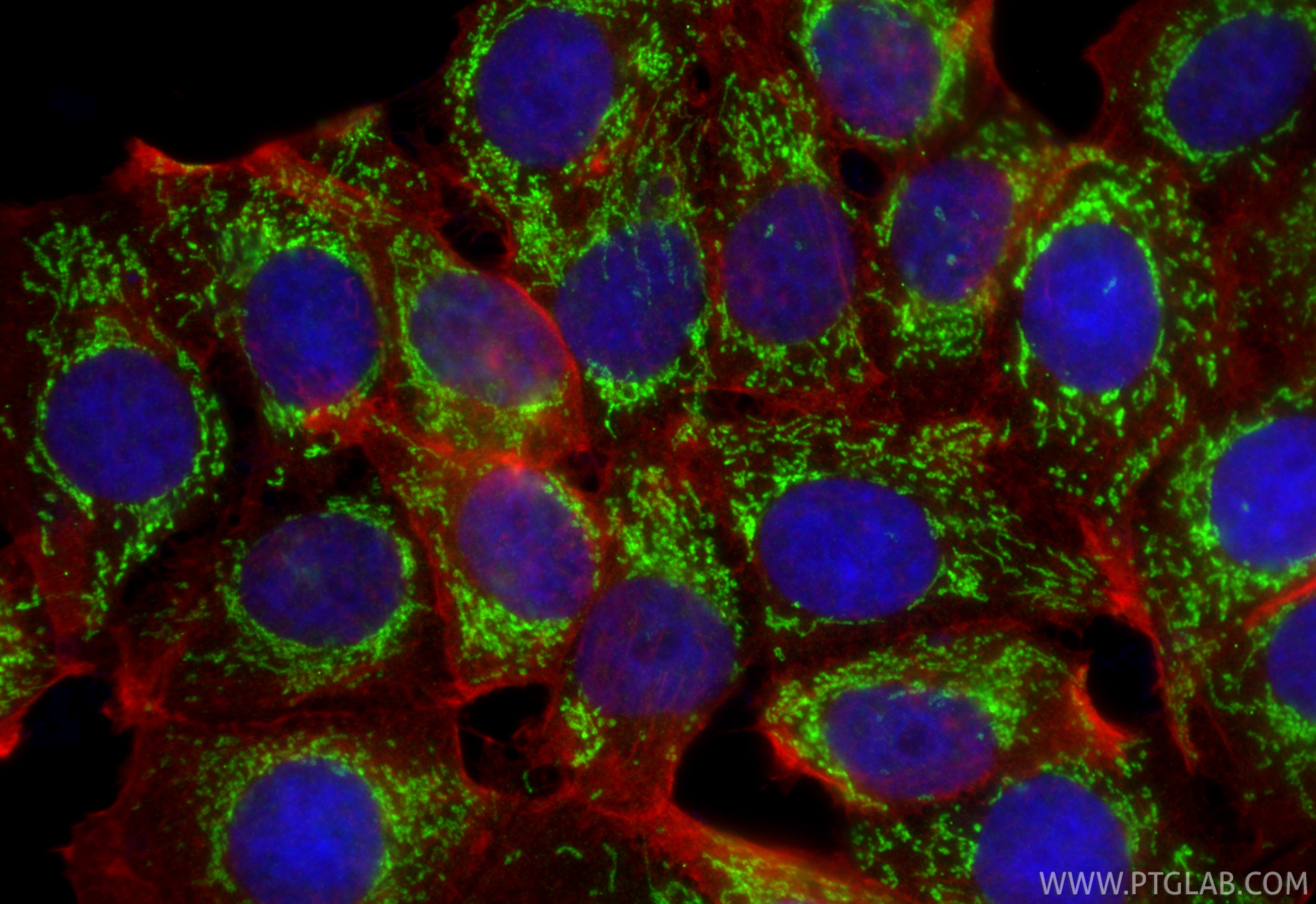 IF Staining of MCF-7 using 27493-1-AP IF Staining of MCF-7 using 27493-1-AP