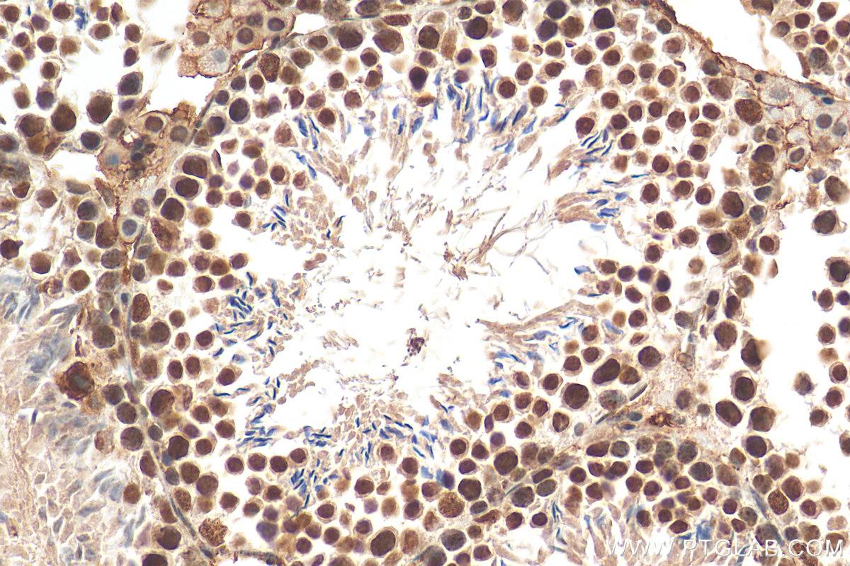 IHC staining of mouse testis using 12265-1-AP