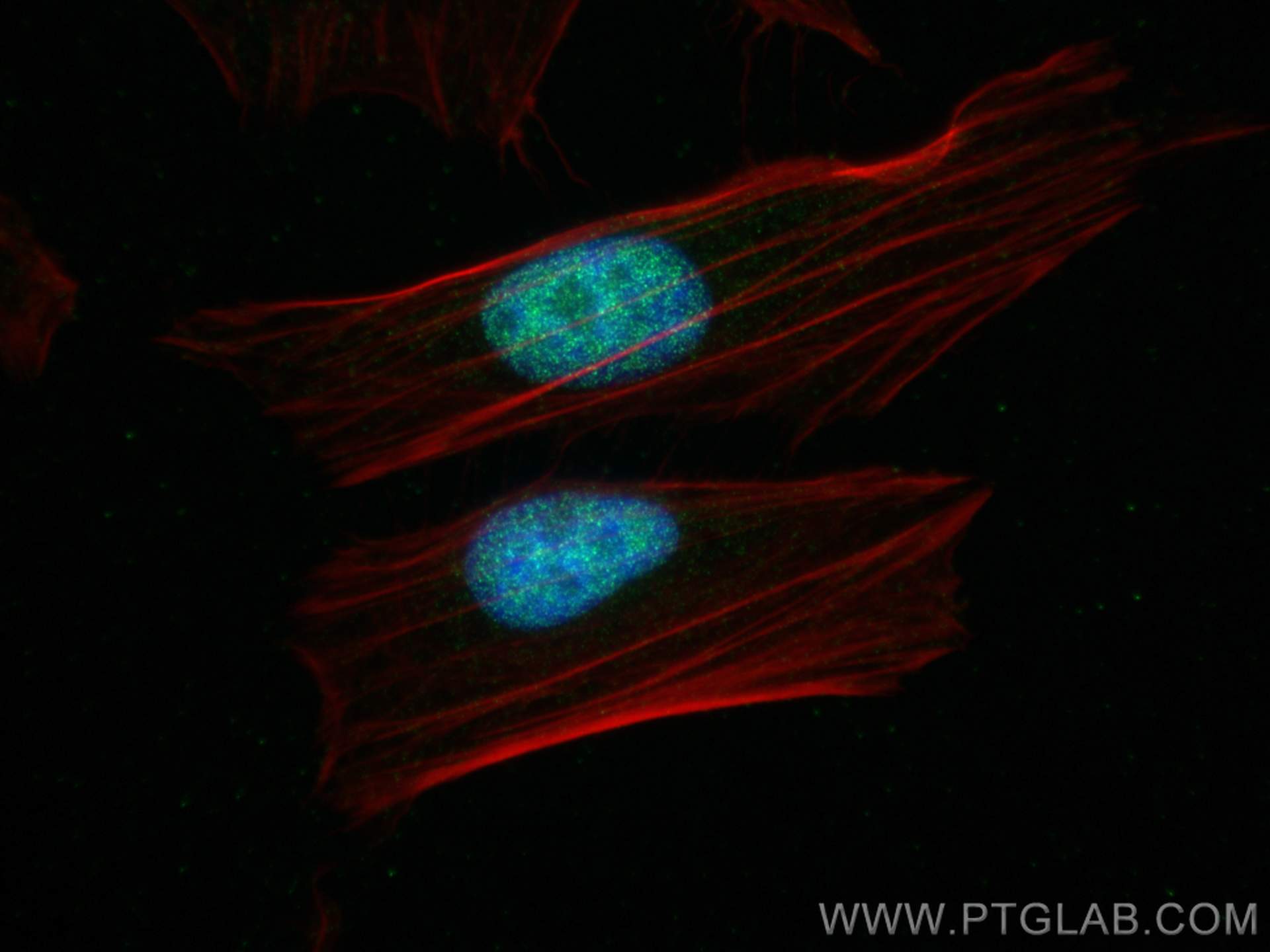 IF Staining of HeLa using 82137-1-RR (same clone as 82137-1-PBS)