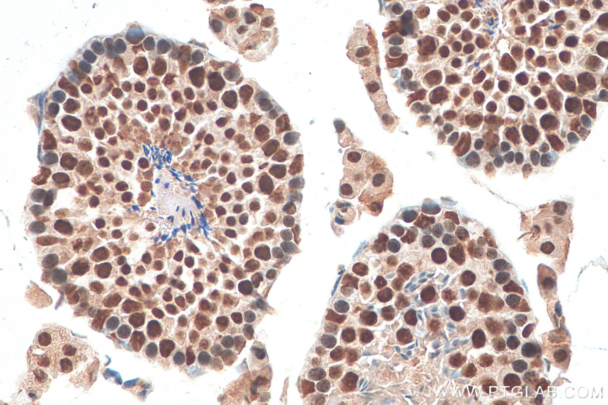 IHC staining of mouse testis using 82137-1-RR (same clone as 82137-1-PBS)