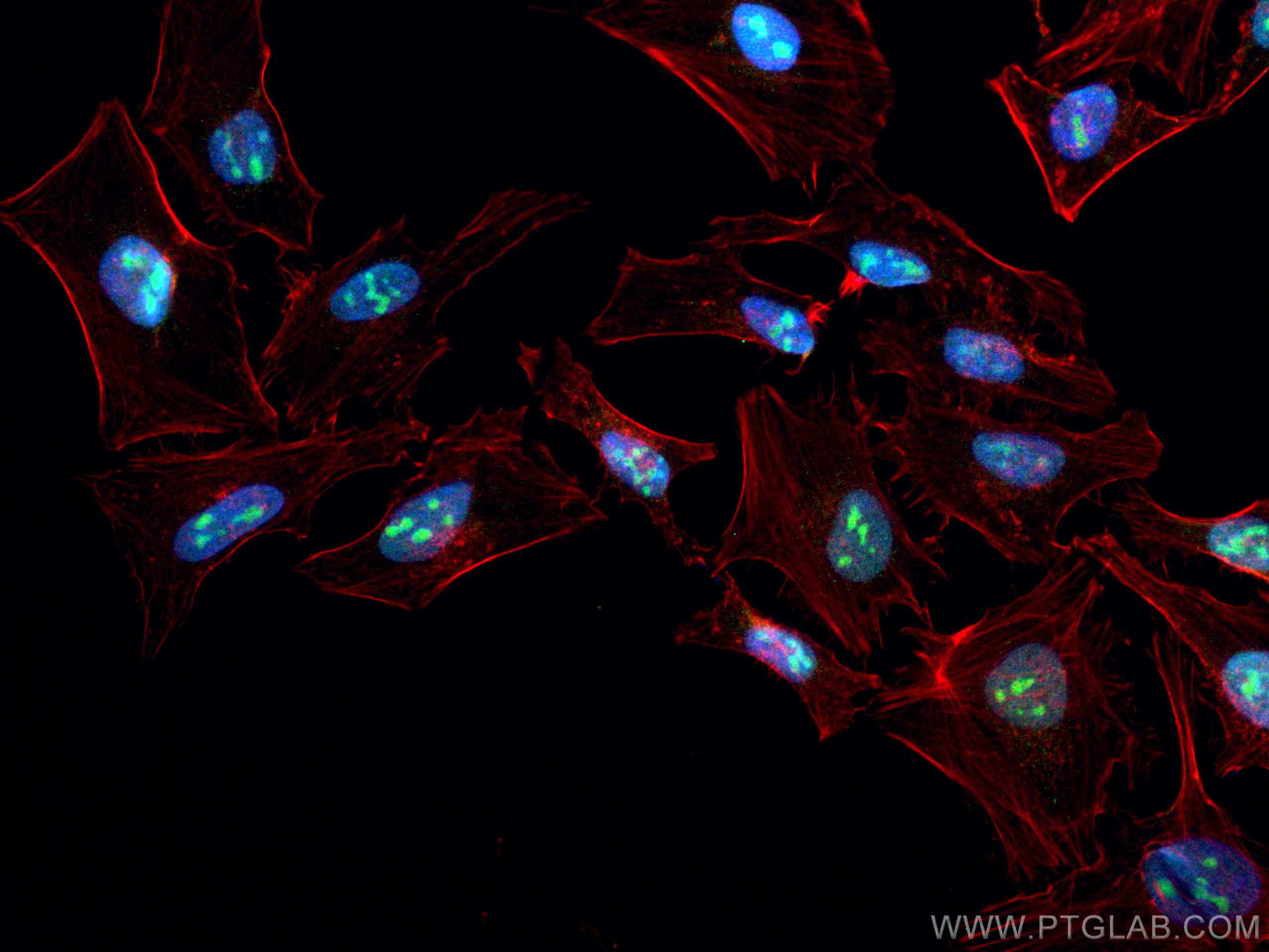 IF Staining of HeLa using 67853-1-Ig