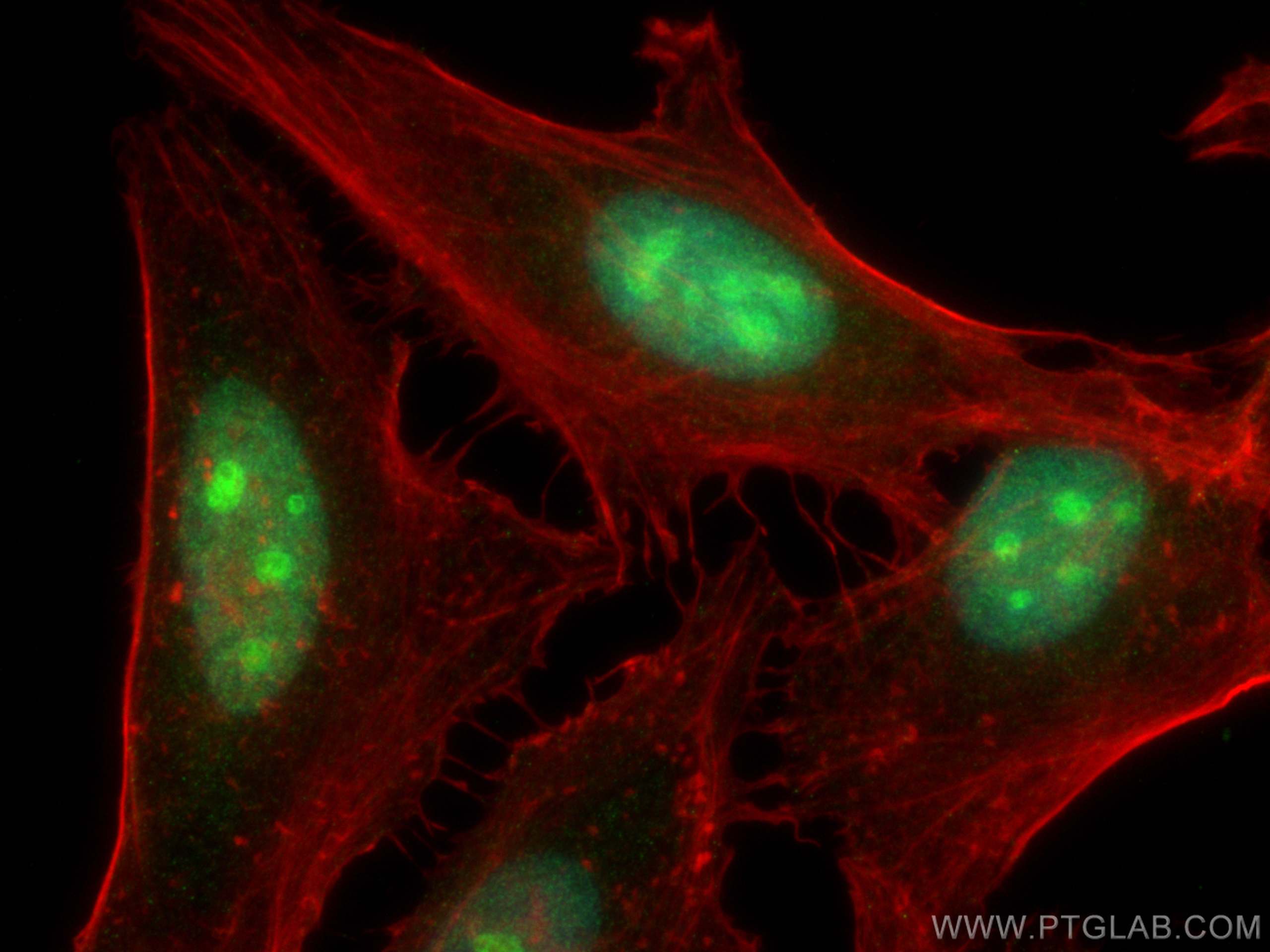 IF Staining of HeLa using 67853-1-Ig