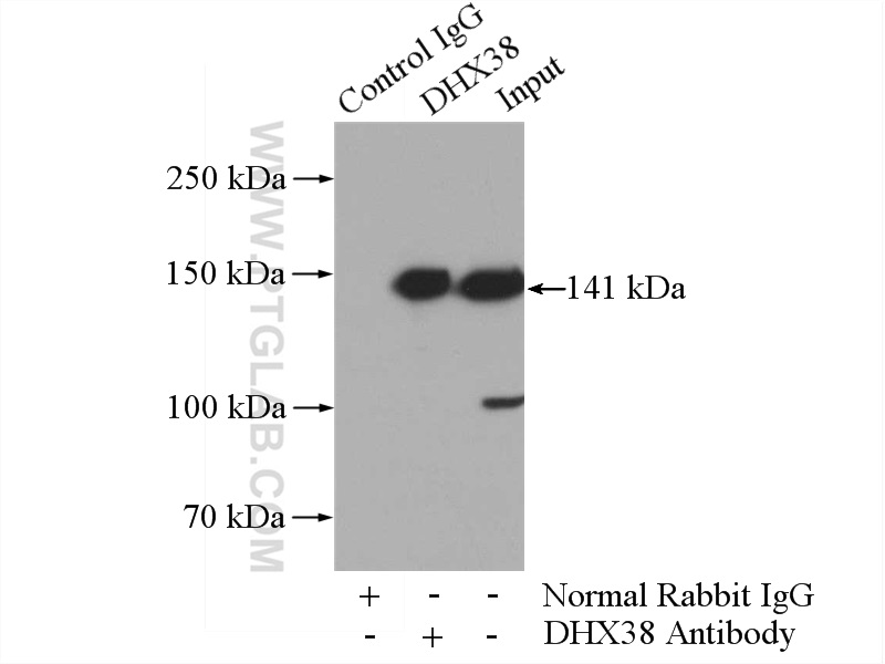 IP experiment of HeLa using 10098-2-AP