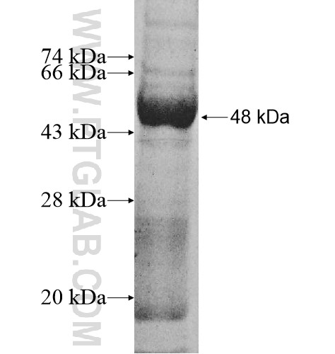 DHX40 fusion protein Ag10823 SDS-PAGE DHX40 fusion protein Ag10823 SDS-PAGE