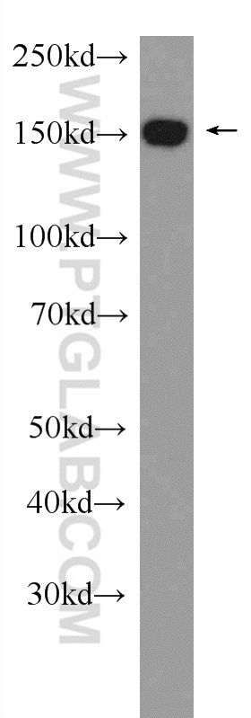 WB analysis of HeLa using 24525-1-AP