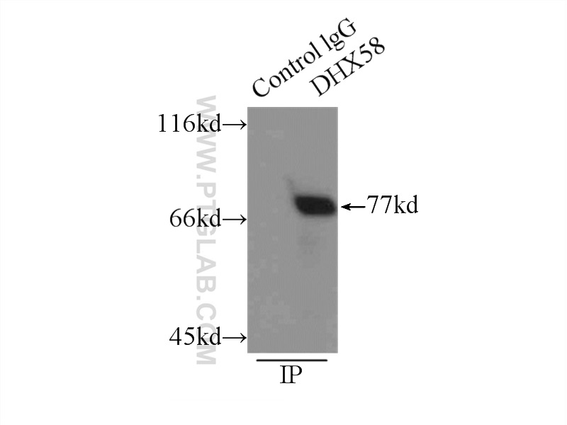 IP experiment of mouse liver using 11355-1-AP