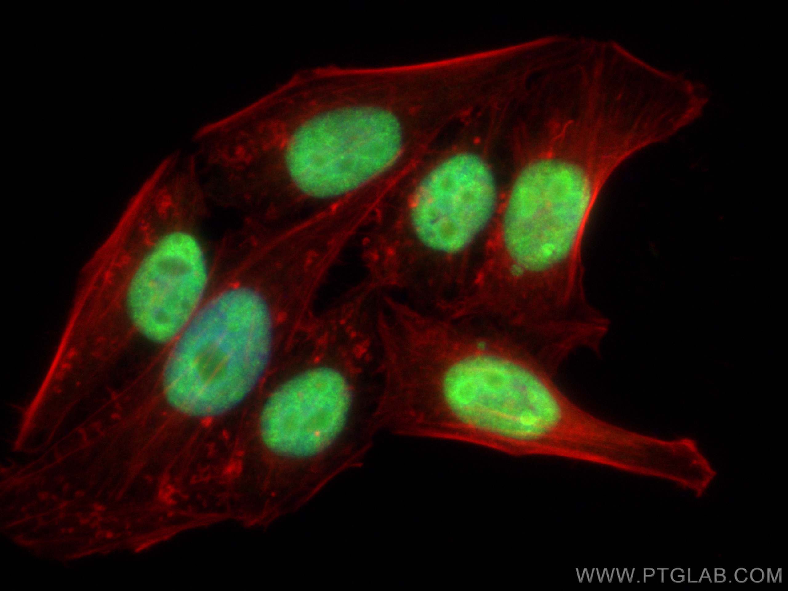 IF Staining of HepG2 using 17721-1-AP