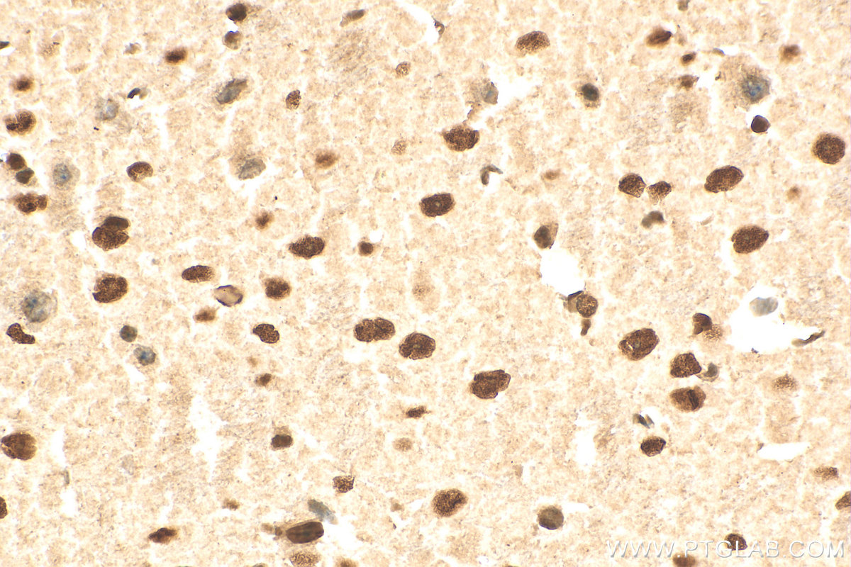 IHC staining of mouse brain using 17721-1-AP