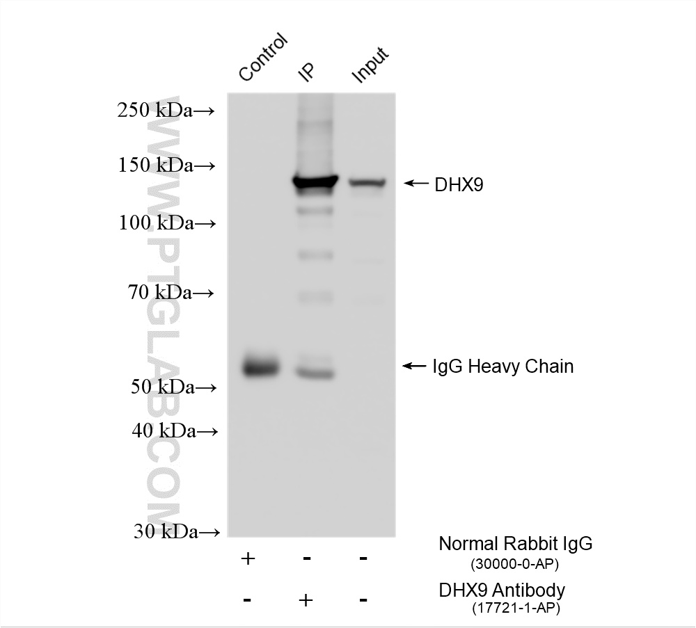 IP experiment of HeLa using 17721-1-AP IP experiment of HeLa using 17721-1-AP