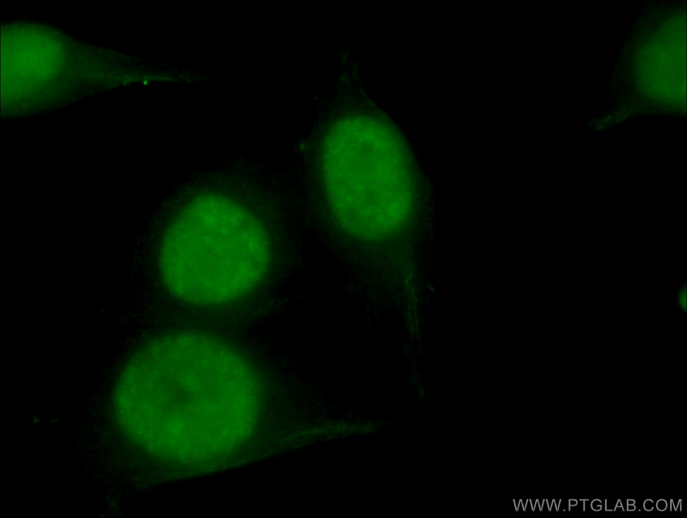 IF Staining of HepG2 using 67153-1-Ig