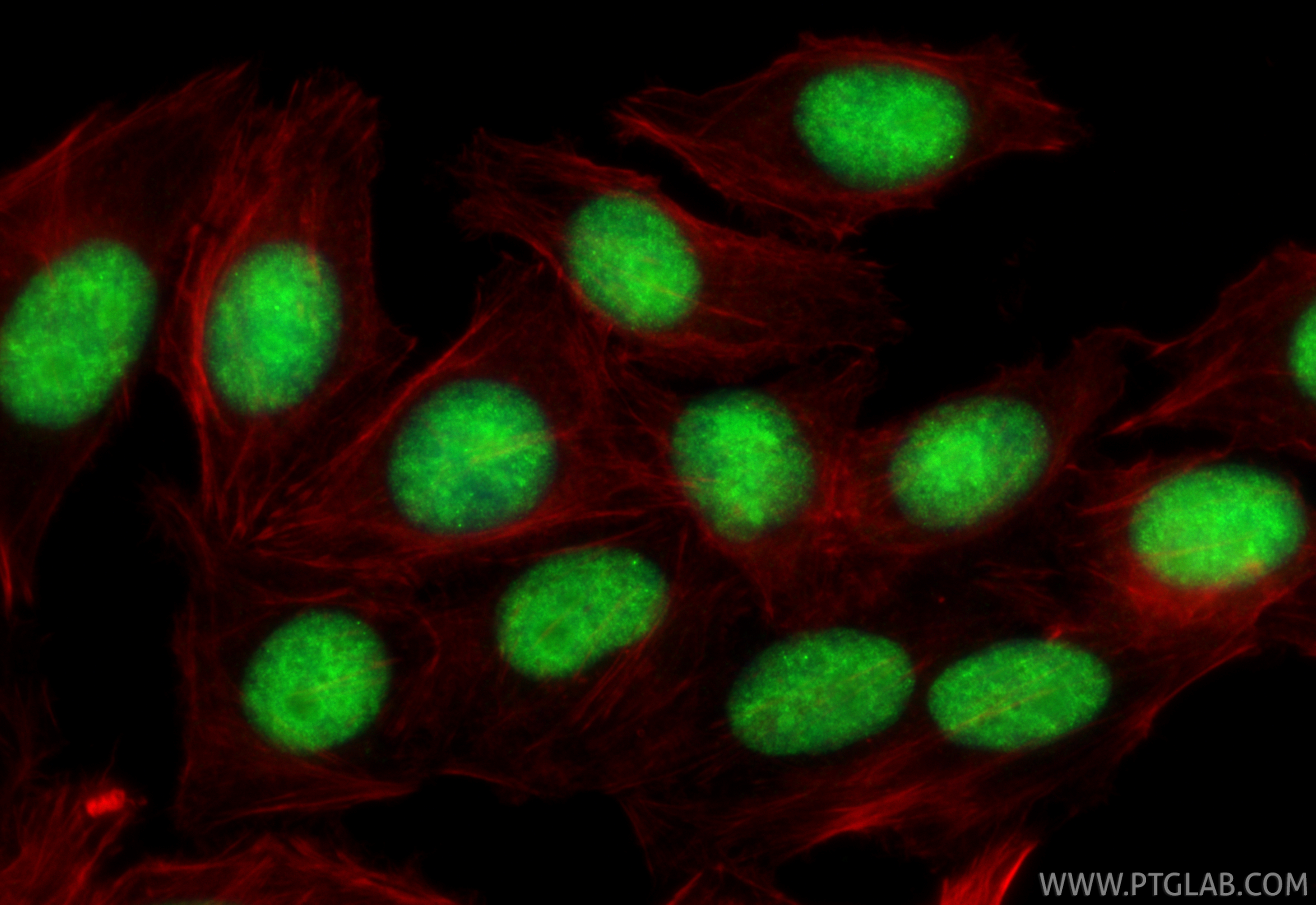 IF Staining of HepG2 using 67153-1-Ig IF Staining of HepG2 using 67153-1-Ig
