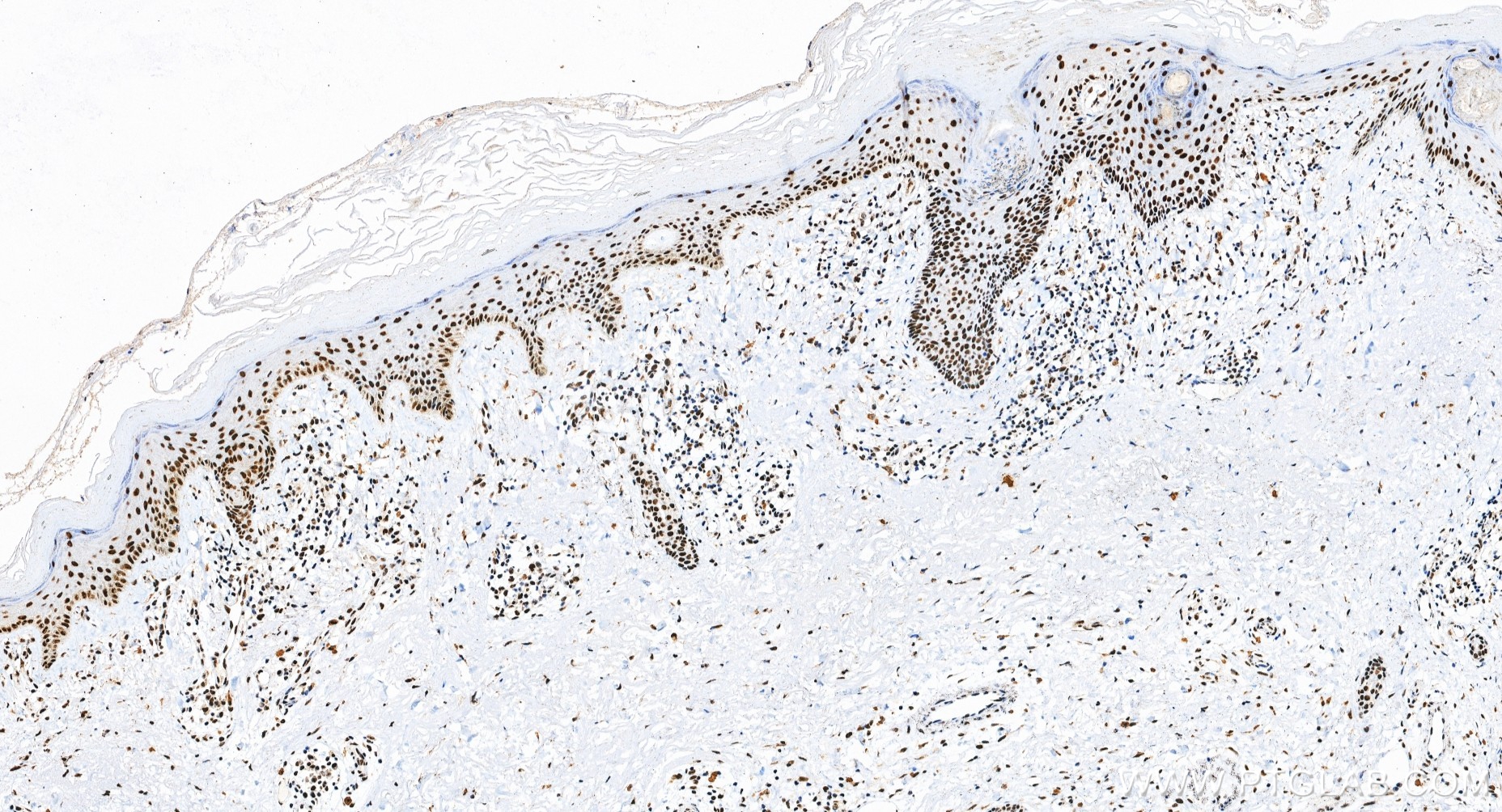IHC staining of human skin using 88165-1-RR (same clone as 88165-1-PBS) IHC staining of human skin using 88165-1-RR (same clone as 88165-1-PBS)