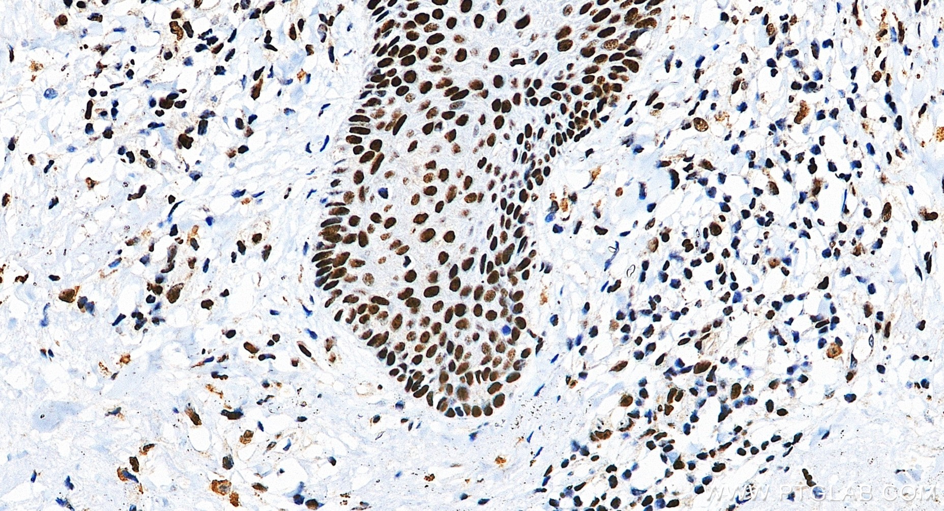 IHC staining of human skin using 88165-1-RR (same clone as 88165-1-PBS) IHC staining of human skin using 88165-1-RR (same clone as 88165-1-PBS)