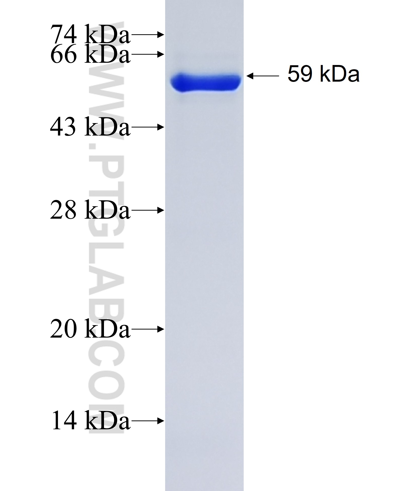 DHX9 fusion protein Ag0572 SDS-PAGE